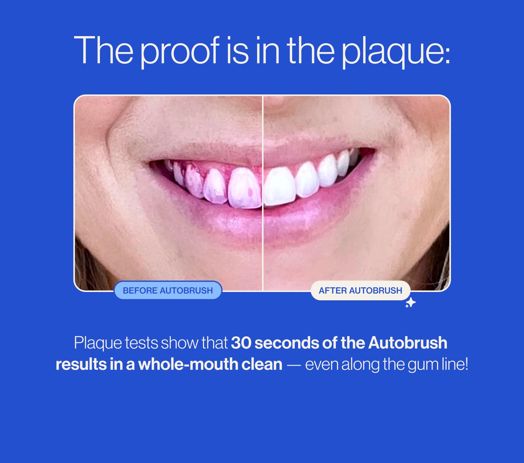 AUTOBRUSH Sonic Pro Electric Toothbrush - ADA Accepted U-Shaped