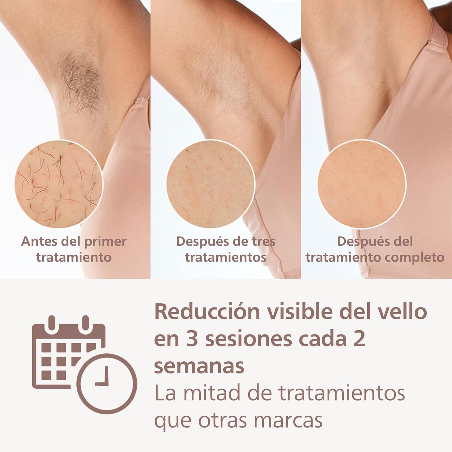 Philips Lumea Series 9000, Pulsed Light Epilator, IPL, Smooth Skin at Home