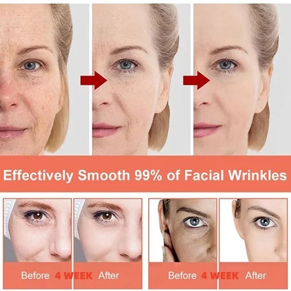 Last Day Promotion 49% OFF-PIBAMY Whitening and spot removing serum