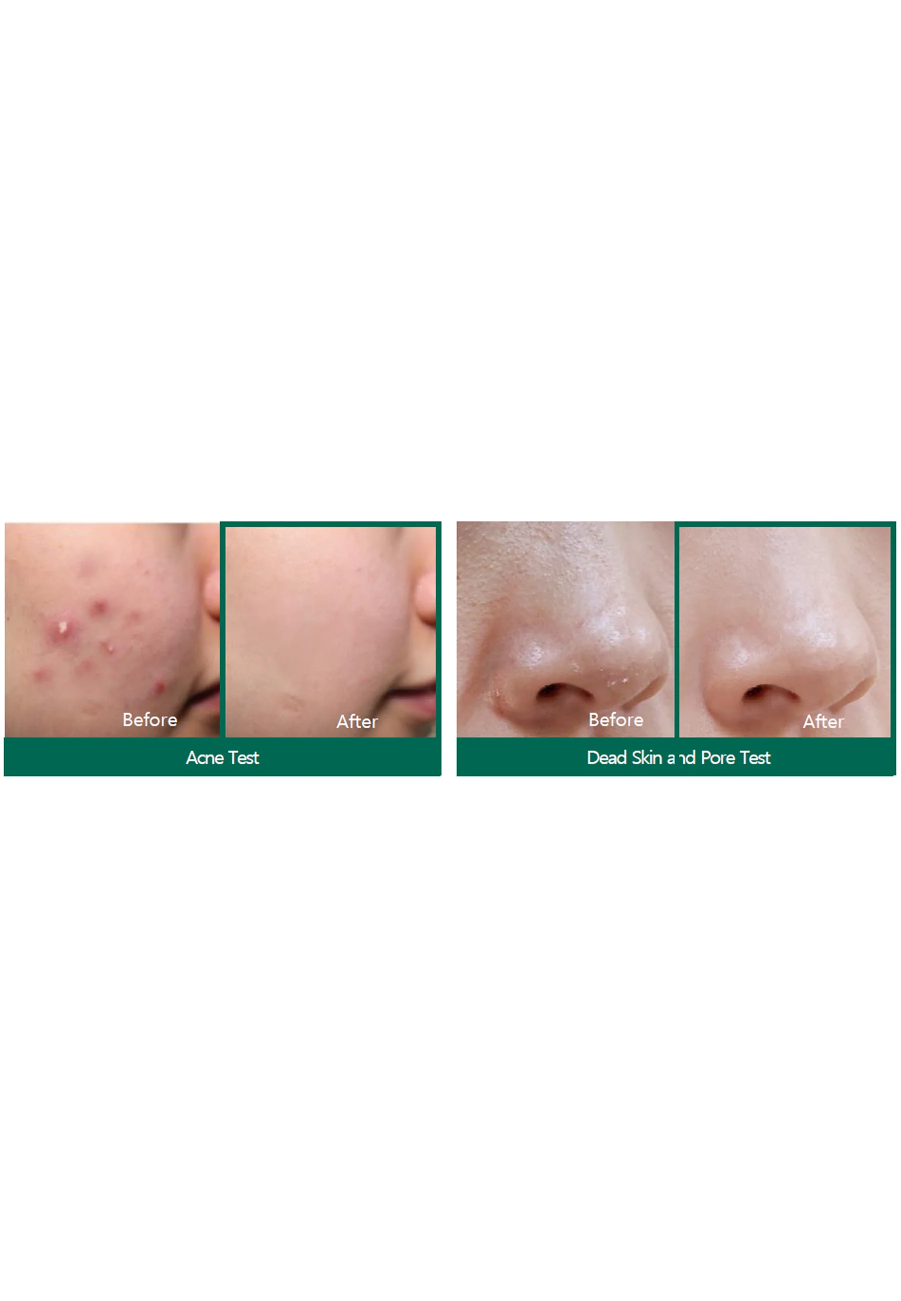 SOME BY MI AHA-BHA-PHA 30 DAYS MIRACLE CREAM - Crema da giorno