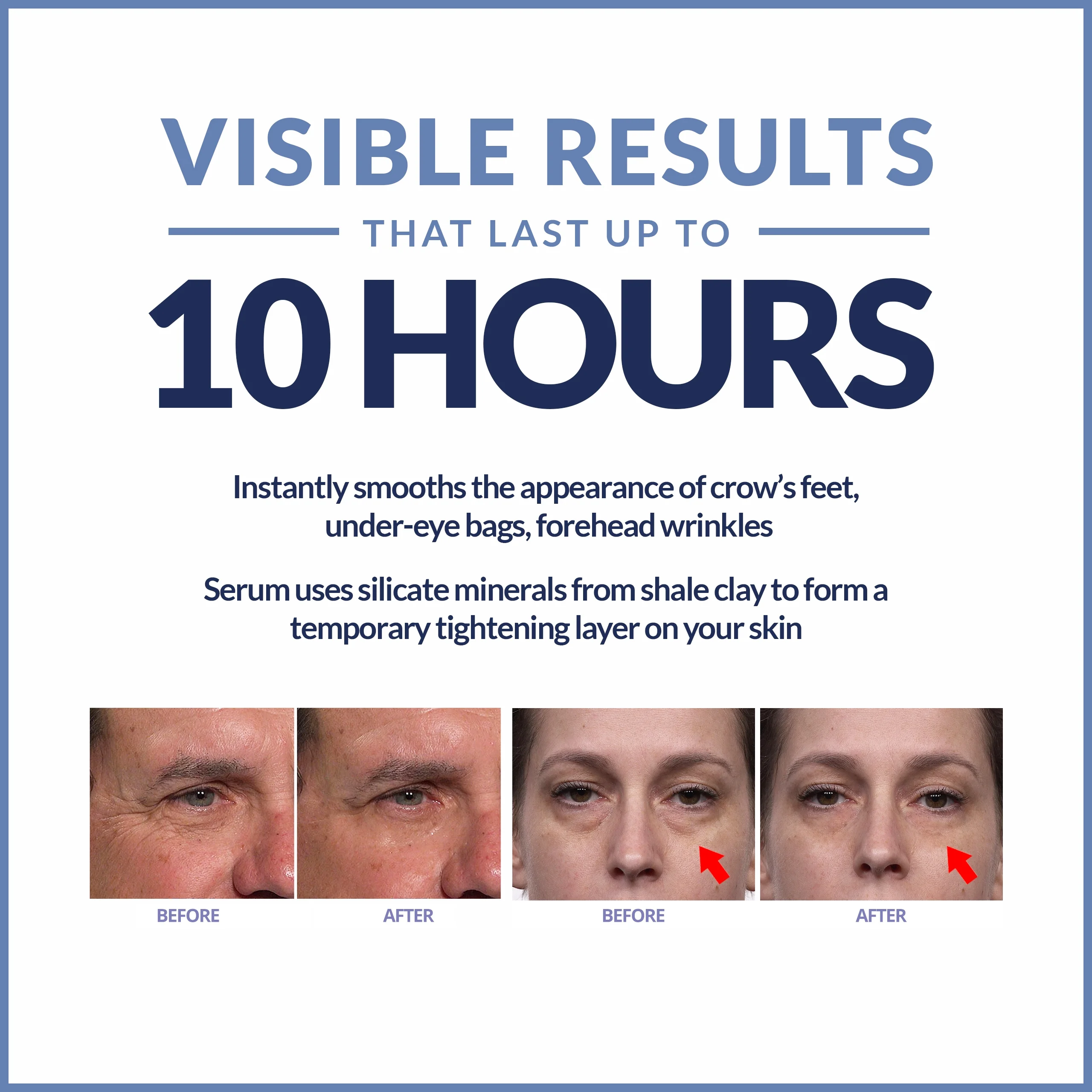 Plexaderm Rapid Reduction Serum - New Single Use Pods - Age-Defying Eye Treatment - Reduce the Look of Under-Eye Bags & Wrinkles, Diminish the Appearance of Dark Circles, Fine Lines &a