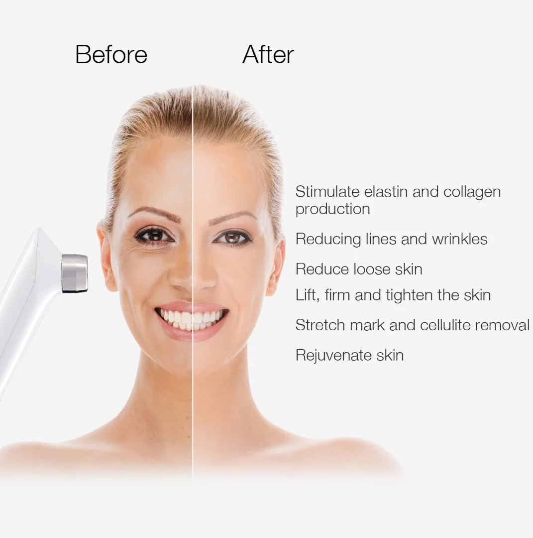 RF Radio Frequency Facial And Body Skin Tightening Machine,Professional Home RF Skin Care Anti Aging Device