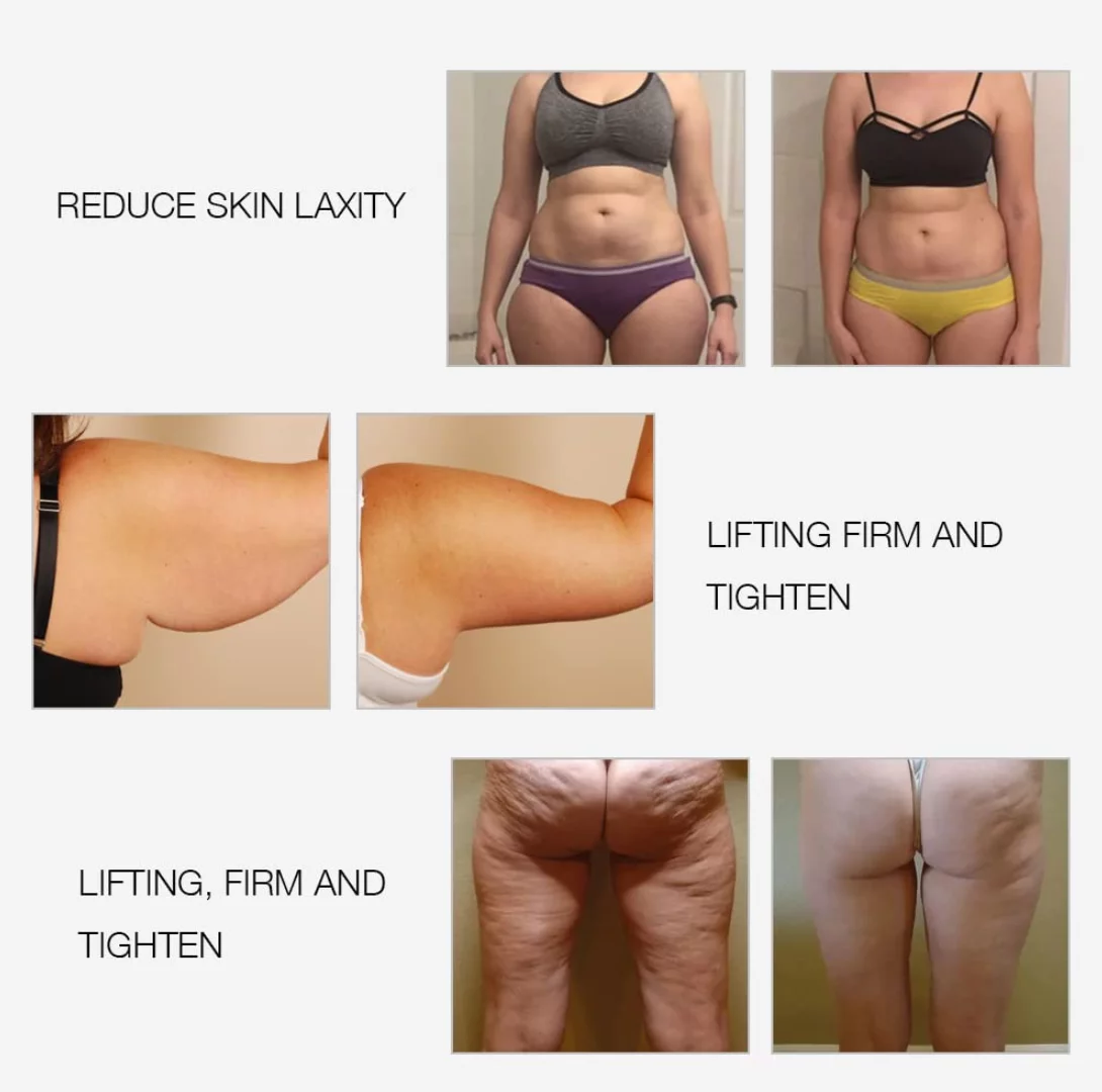 RF Radio Frequency Facial And Body Skin Tightening Machine,Professional Home RF Skin Care Anti Aging Device