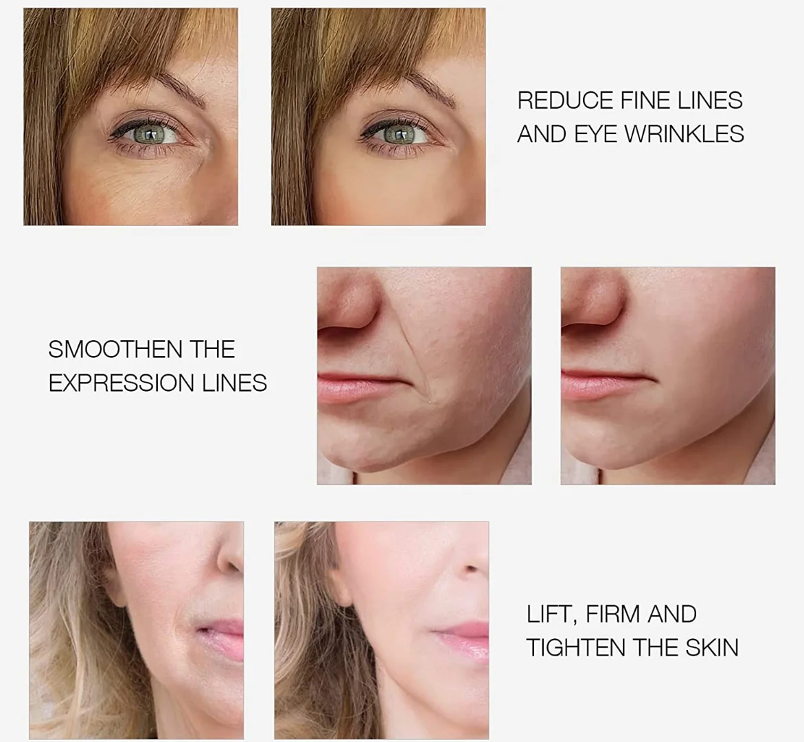 RF Radio Frequency Facial And Body Skin Tightening Machine,Professional Home RF Skin Care Anti Aging Device