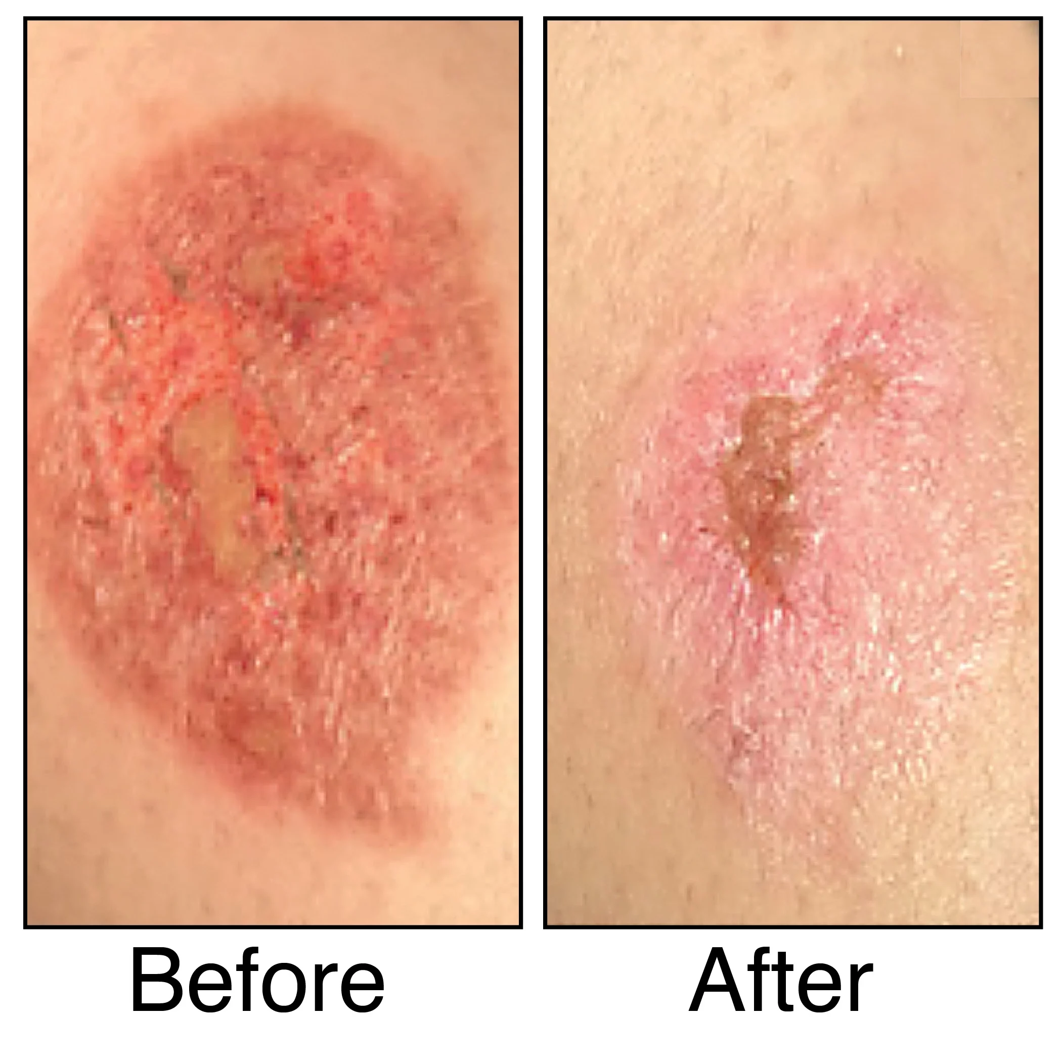 Collections Etc Body Verde Miracle Skin Renewal Natural Skin Care Product