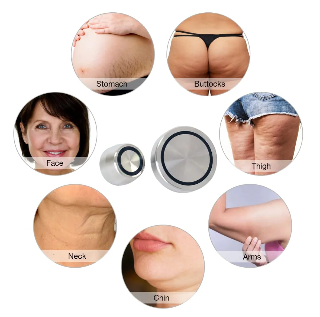 RF Radio Frequency Facial And Body Skin Tightening Machine,Professional Home RF Skin Care Anti Aging Device