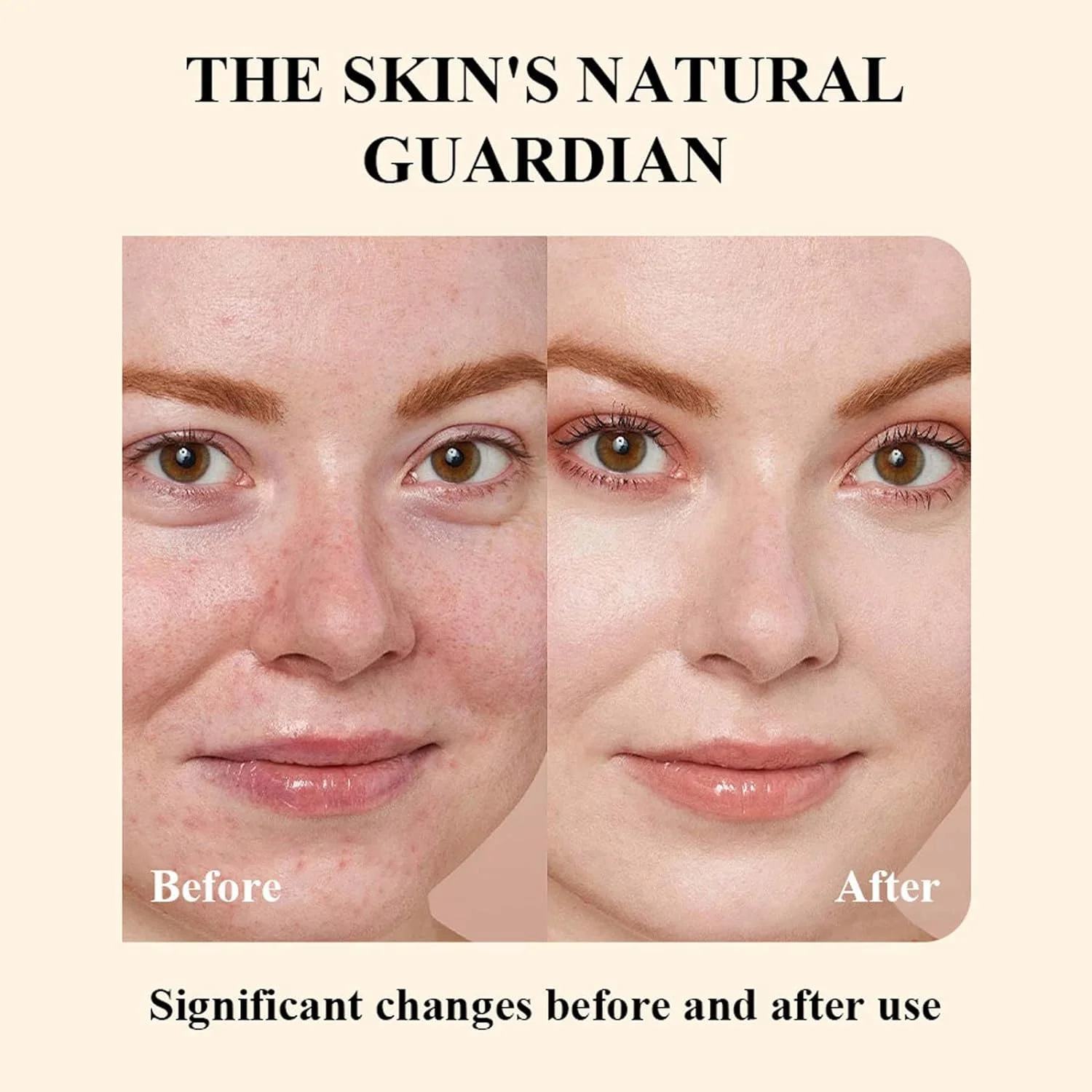 ZUANYETD Beef Tallow Creme für Die Hautpflege, Rinderhalsbalsam, 100% Faltenverteidigung Tallow Balm, Grass Fed Tallow Raw Wild Honey, Gesicht und Körper Gepeitschte Feuchtigkeitscreme