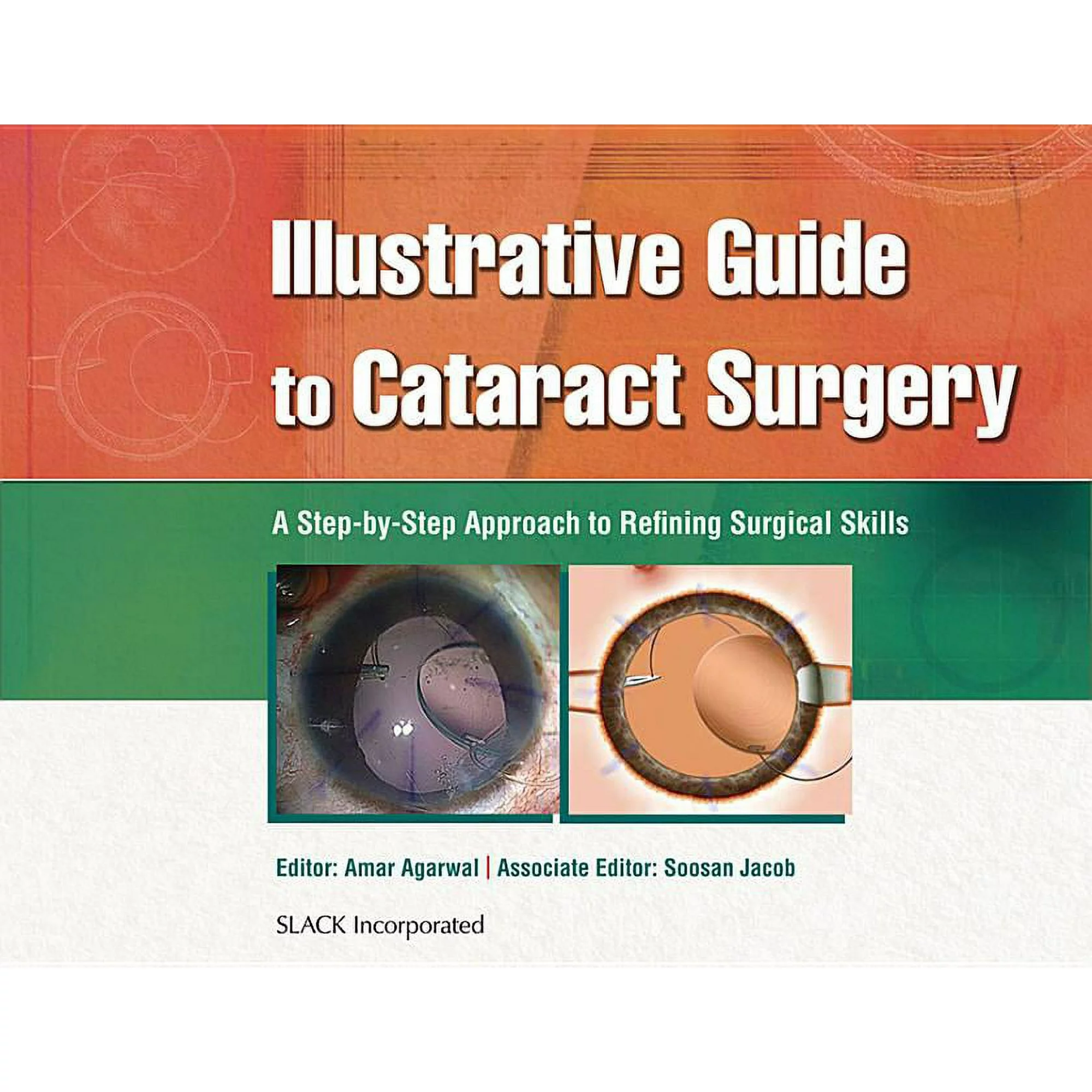 Illustrative Guide to Cataract Surgery : A Step-by-Step Approach to Refining Surgical Skills (Hardcover)
