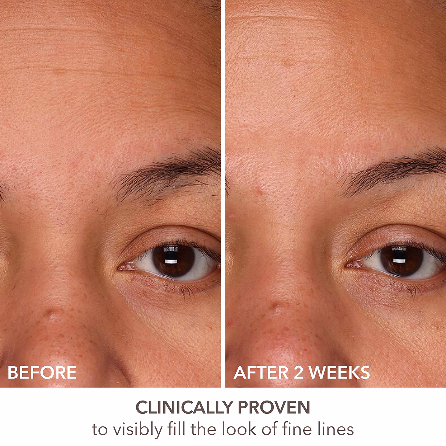 DermInfusions? Fill + Repair Serum