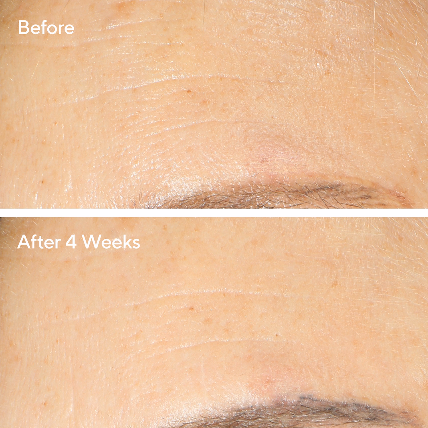 Retinol Youth Renewal Night Cream