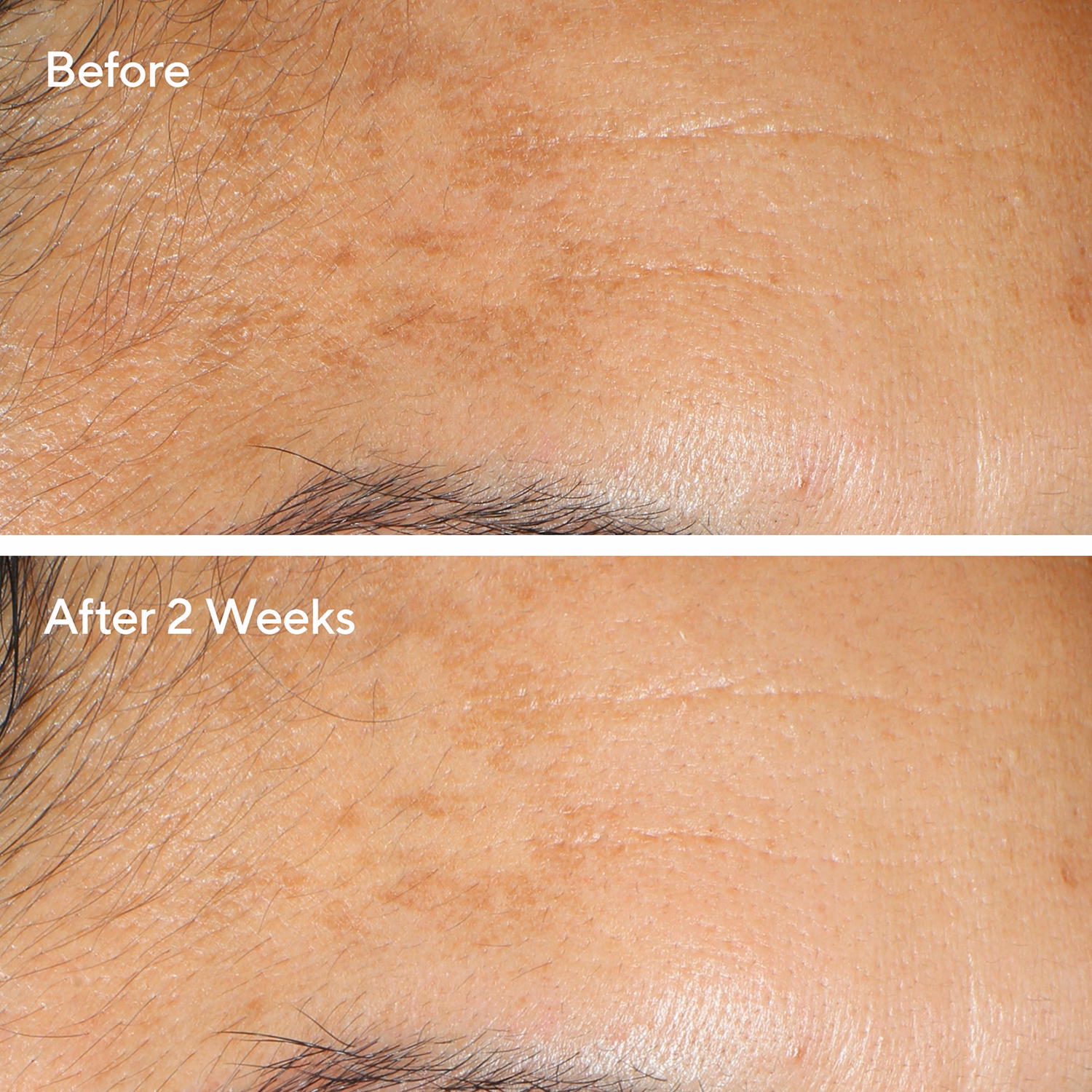 Serum Vita-C Glycolic