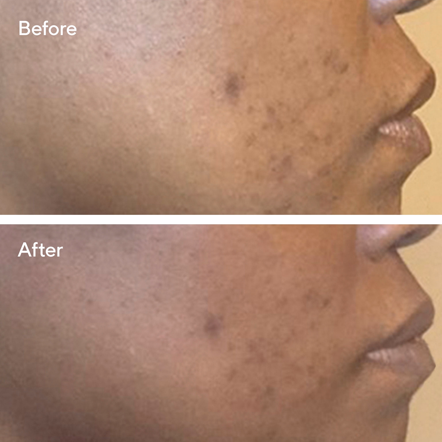 Correct & Protect Broad Spectrum SPF 45? | PA++++