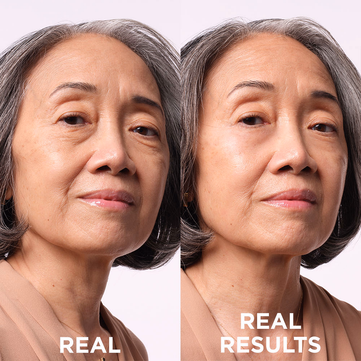 Bye Bye Under Eye Bags Rapid Bag Reducer