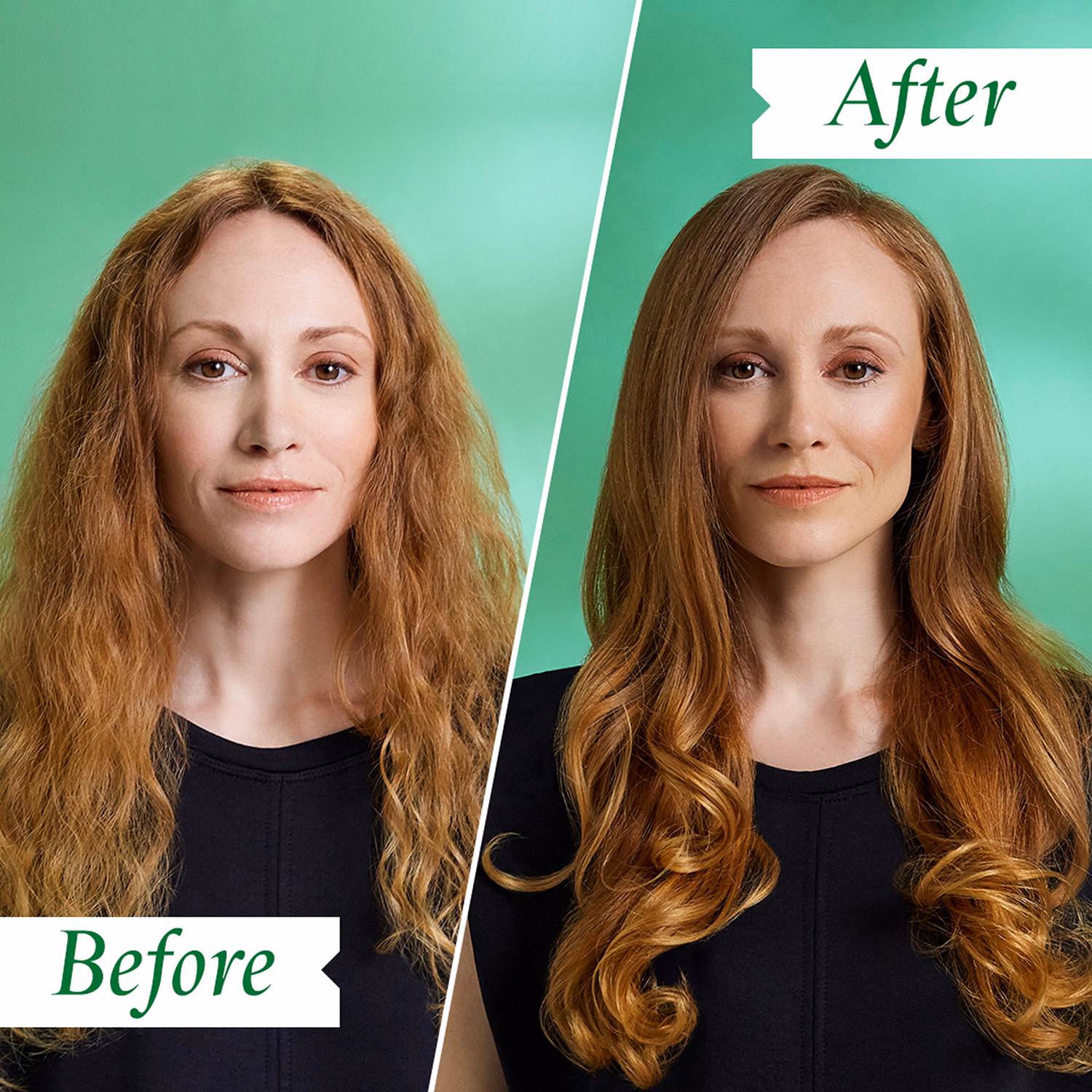 Flaky/Itchy Regime Kit