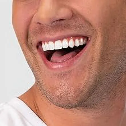 Opalescence 20% PF Mint Teeth Whitening Syringe Gel Refill Kit by Ultradent – Professional Dental Whitener (12 Syringes, Carbamide Peroxide Based)