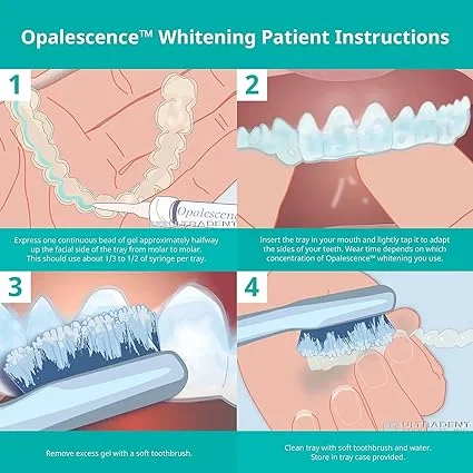Opalescence 20% PF Mint Teeth Whitening Syringe Gel Refill Kit by Ultradent – Professional Dental Whitener (12 Syringes, Carbamide Peroxide Based)