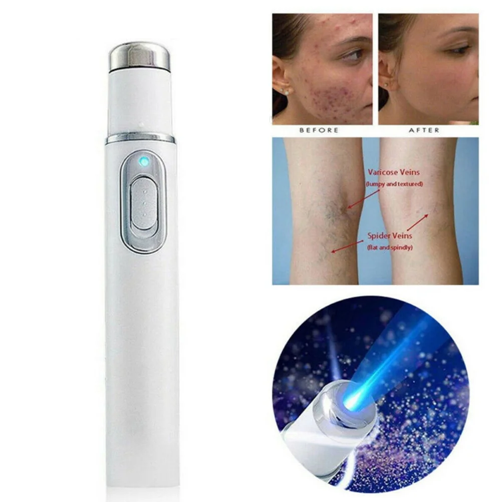 Blue Light Therapy Pen for Spider Veins Acne Removal Pen Scar Wrinkles Puffy Eyes Dark Circles Removal Pen