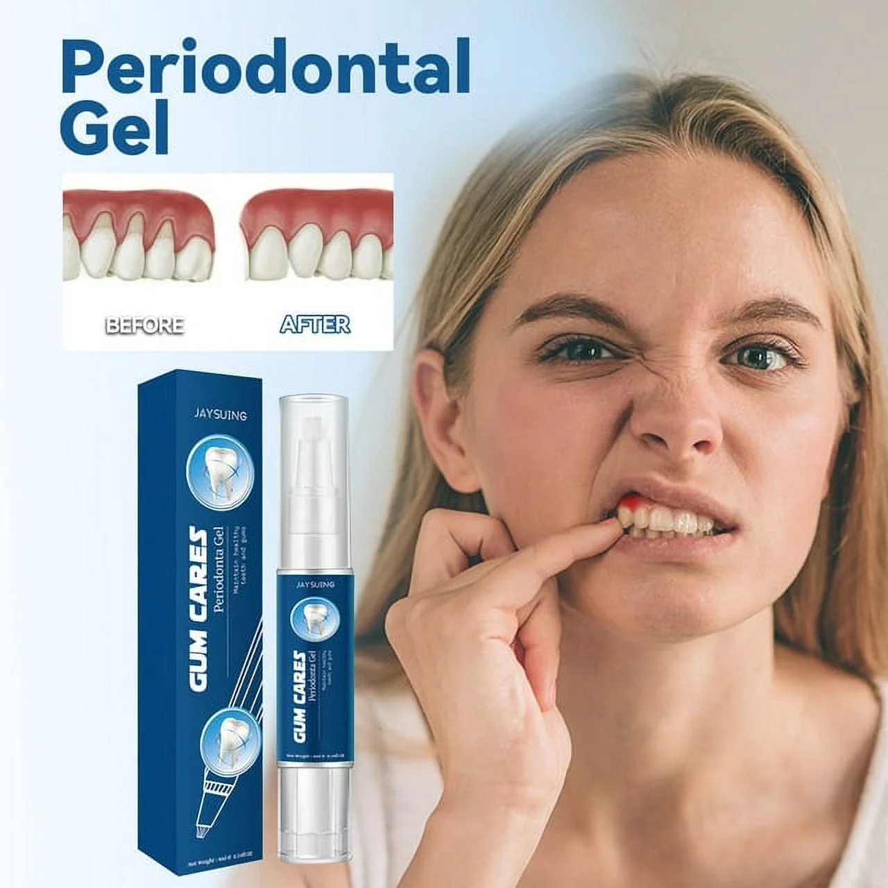 Gum Care Periodontal Gel Gums Therapy Inflammation Receding A