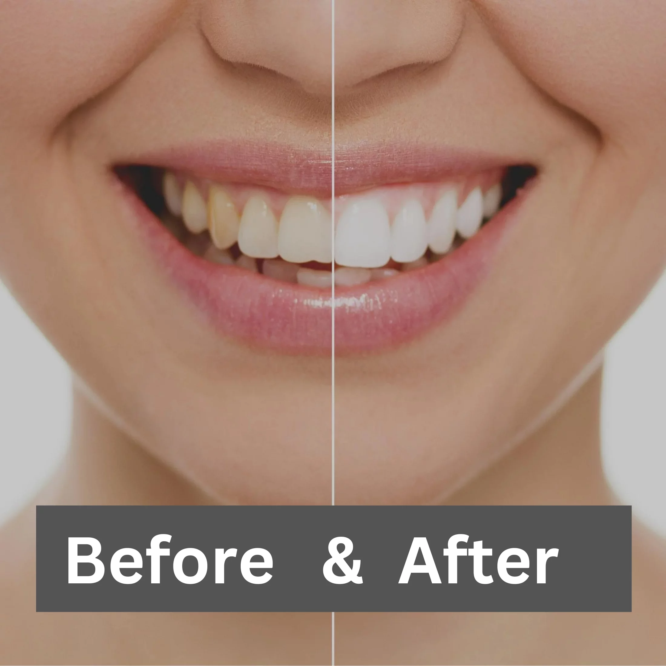 Natural White 5 Minute Teeth Tooth Whitening Kits Gel Comfort Fit Mouth Tray Effective At Home Teeth Whitening Travel Friendly Portable and Easy to Use for Men Women Oral Care 0.75oz each - Pack of 6