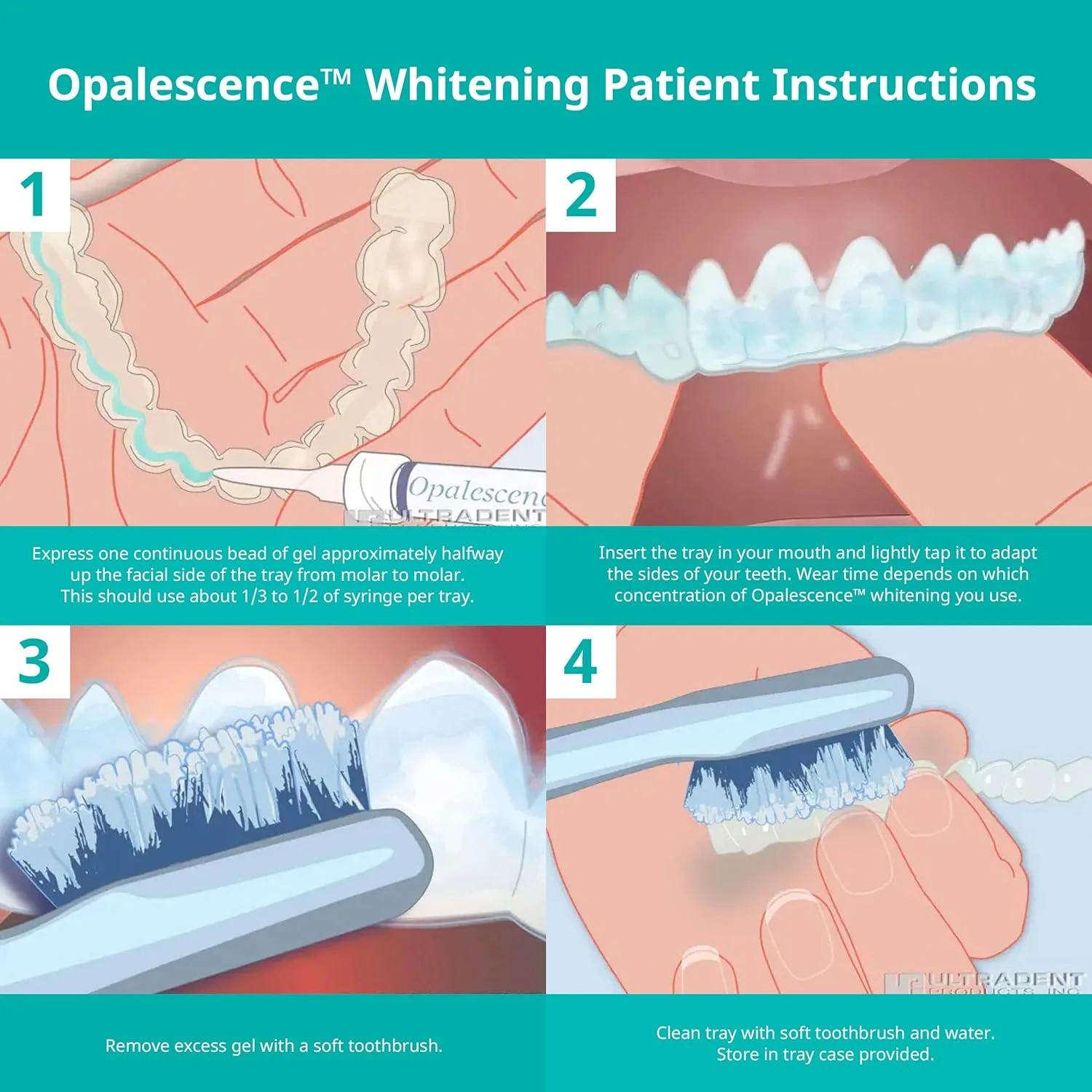 Opalescence 35% Gel Syringes Teeth Whitening Refill Kit (4 Packs / 8 Count) Mint Carbamide Peroxide