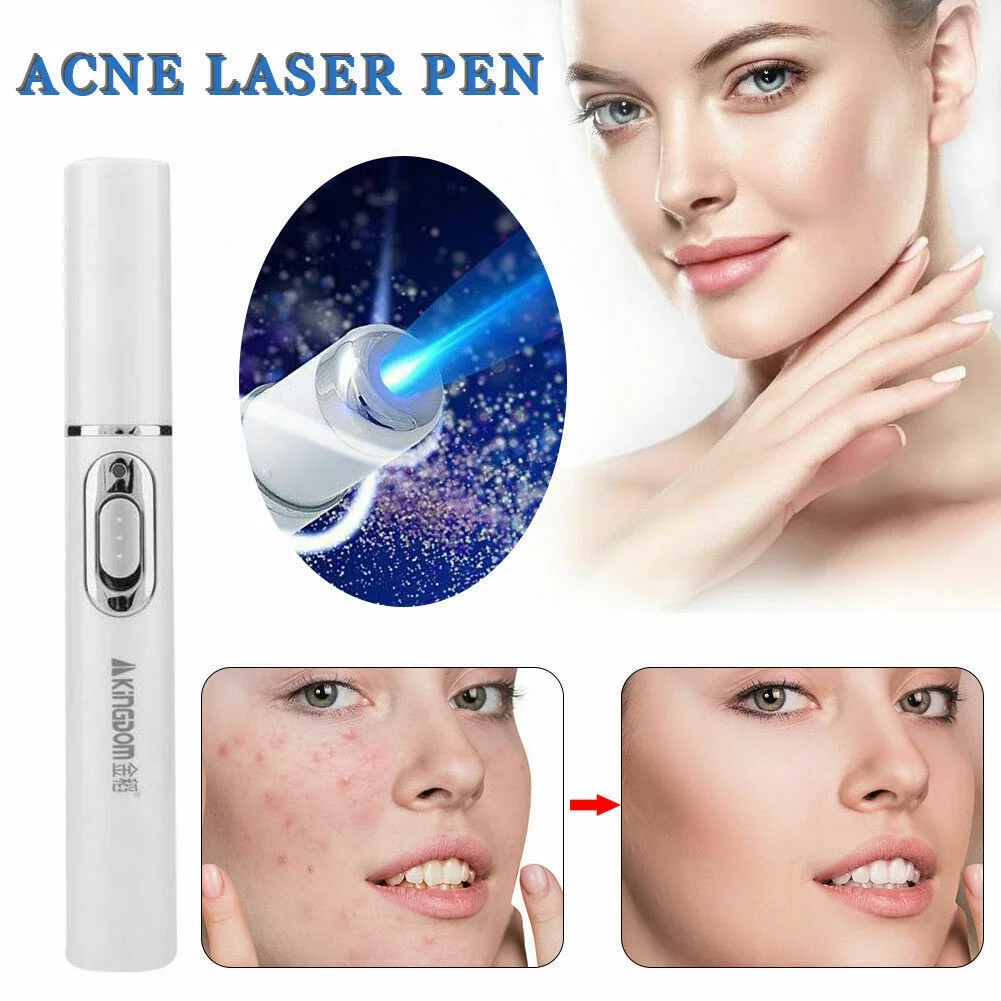XBTCLXEBCO Medical Blue Light Therapy Laser Treatment Pen Acne Skin Care Removal Device NEW