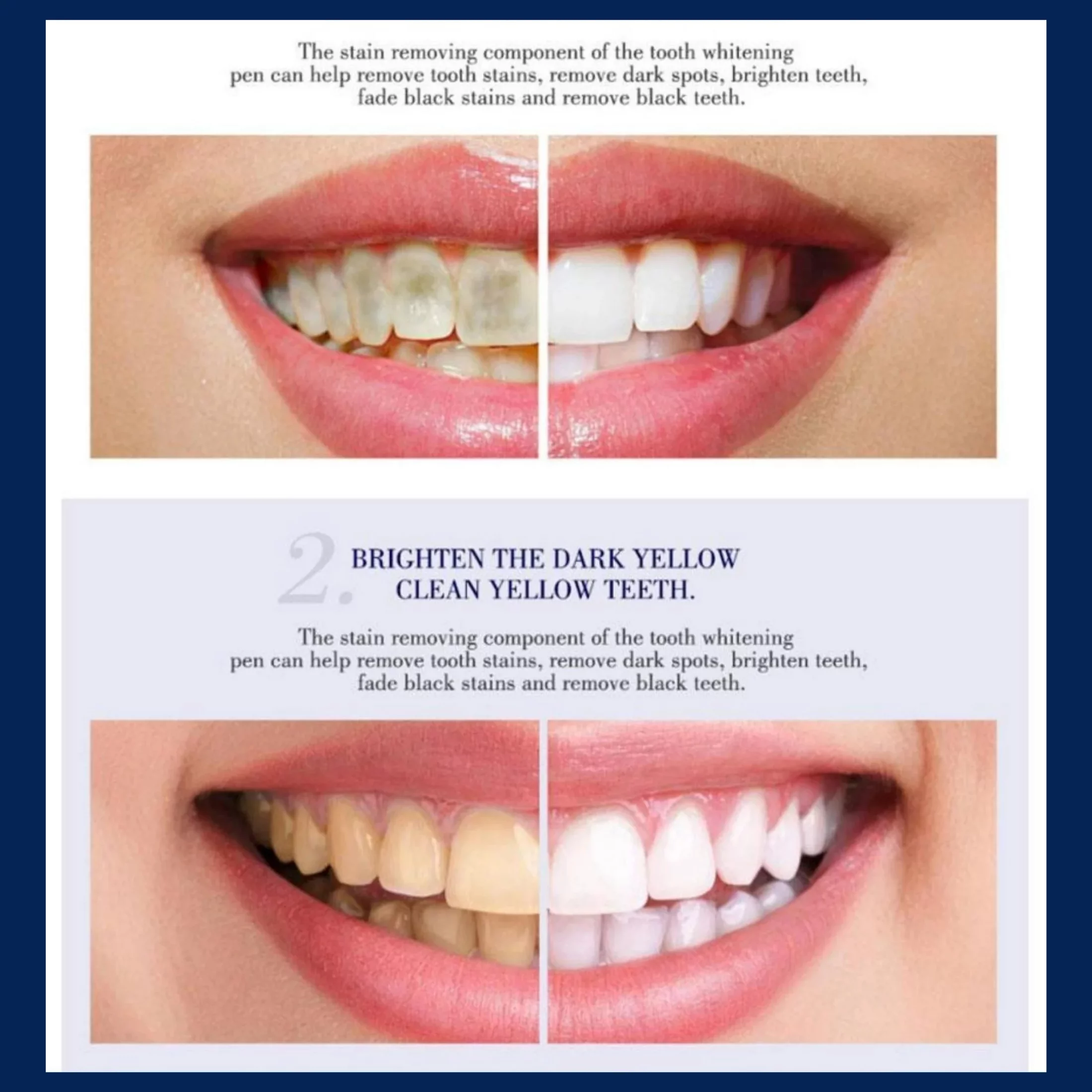 Natural White 5 Minute Teeth Tooth Whitening Kits Gel Comfort Fit Mouth Tray Effective At Home Teeth Whitening Travel Friendly Portable and Easy to Use for Men Women Oral Care 0.75oz each - Pack of 6