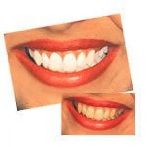 MaxxFoam 50ml Teeth Whitening Foam 8% Hydrogen Peroxide