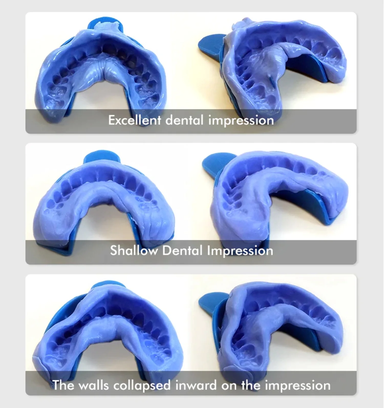 Dental Impression Putty