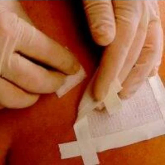 Smith and Nephew Remove Adhesive Remover Wipes 403100, 50ct