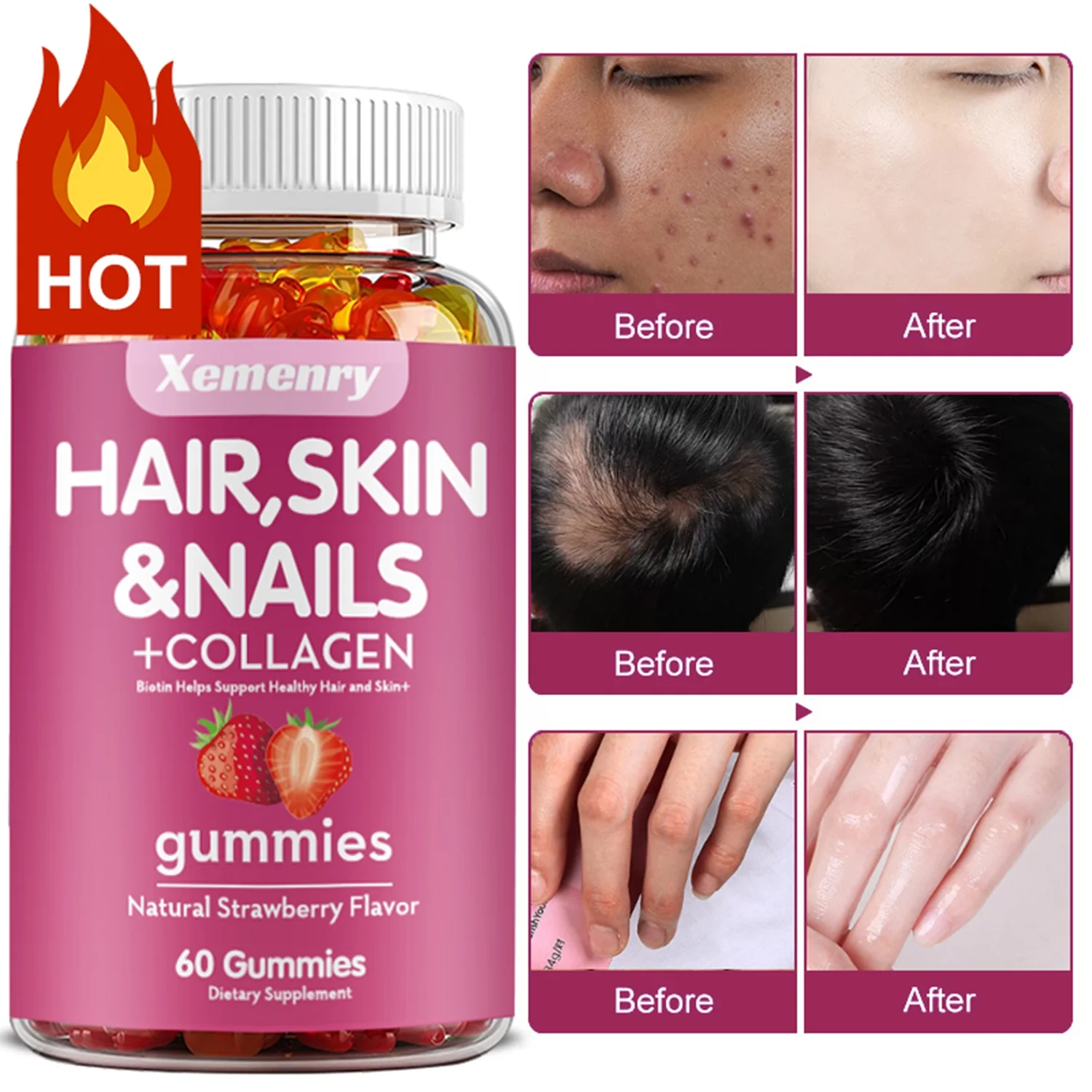 Xemenry Hair, Skin and Nails Gummies-with Biotin,Collagen-Suitable for Hair,Nails,Skin(30/60/100pcs)
