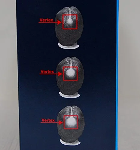 Kirkland Men Hair Loss Regrowth Revitalizes Hair Follicles 5% Minoxidil 3 Months