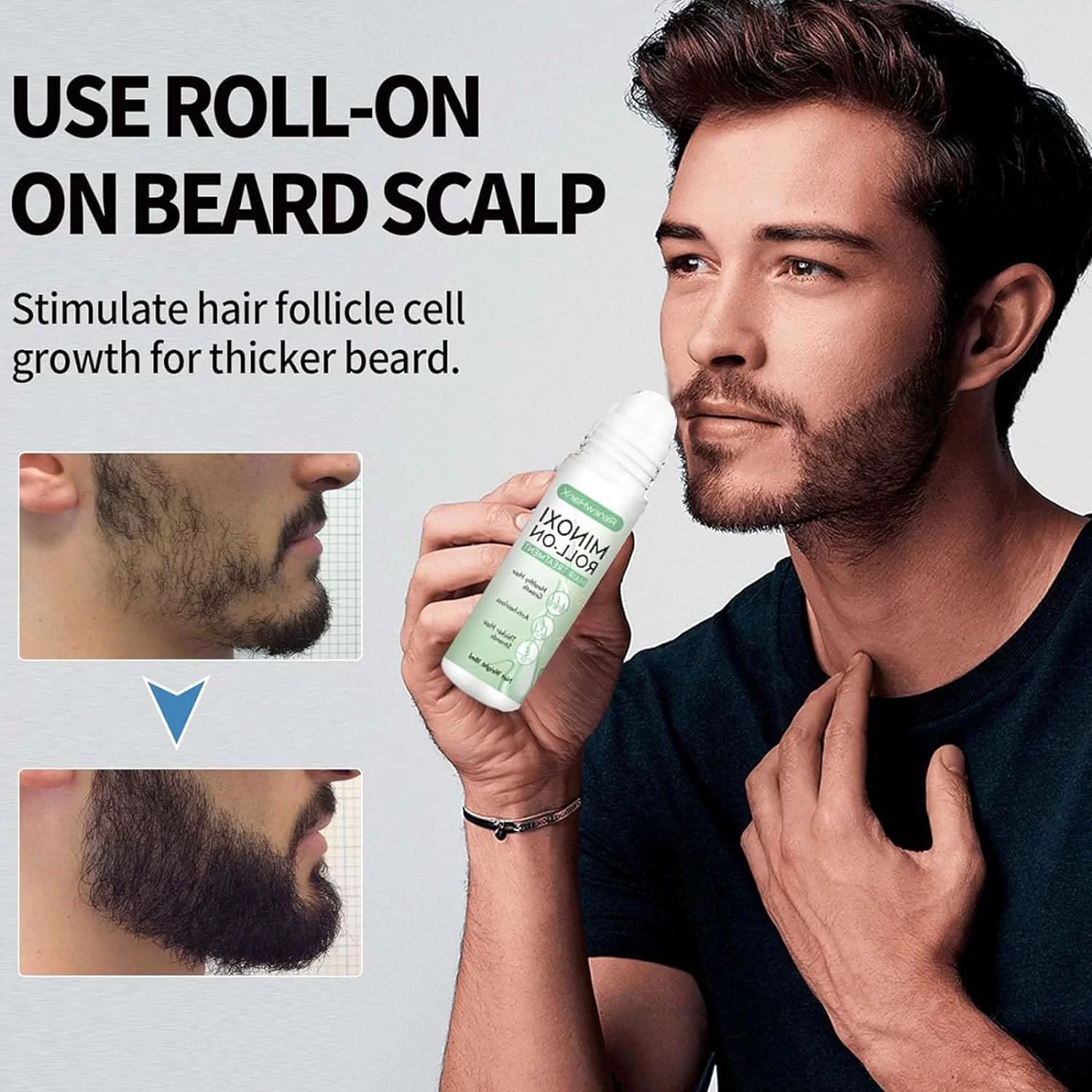 Dense Hair Roller Ball Hair Growth Serum,Roll-On Hair Treatment Scalp Massage Moisture Luxuriant Hair Adult Unisex Hair Care,Hair Follicle Activator,Hair Growth & Thick Hair Essential Oil,2pcs