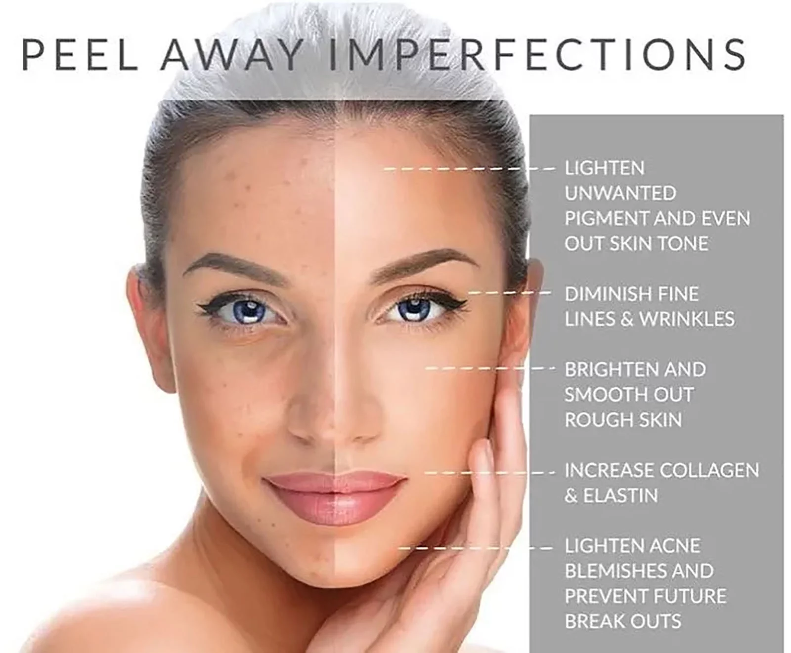 SkinMedica Illuminized Peel