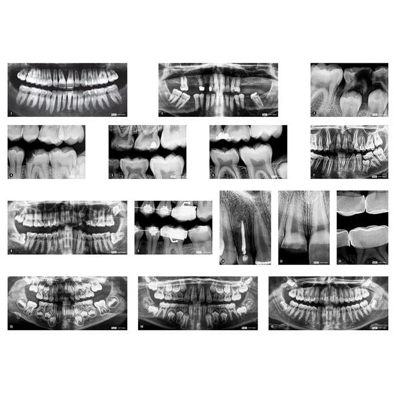 Dental X Rays
