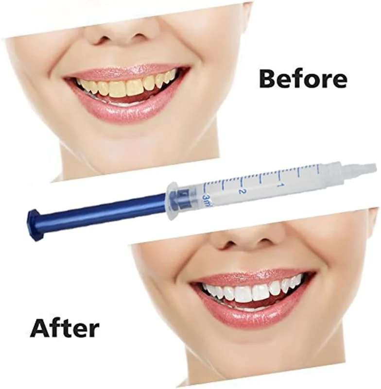 forwillsky 10pcs Teeth Whitening Gels Kit 35% Carbamide Peroxide Bleaching Gel 3ml 0.1oz Refill Gel with Teeth Whitener Lamp Blue LED Light and Teeth Whitening Trays