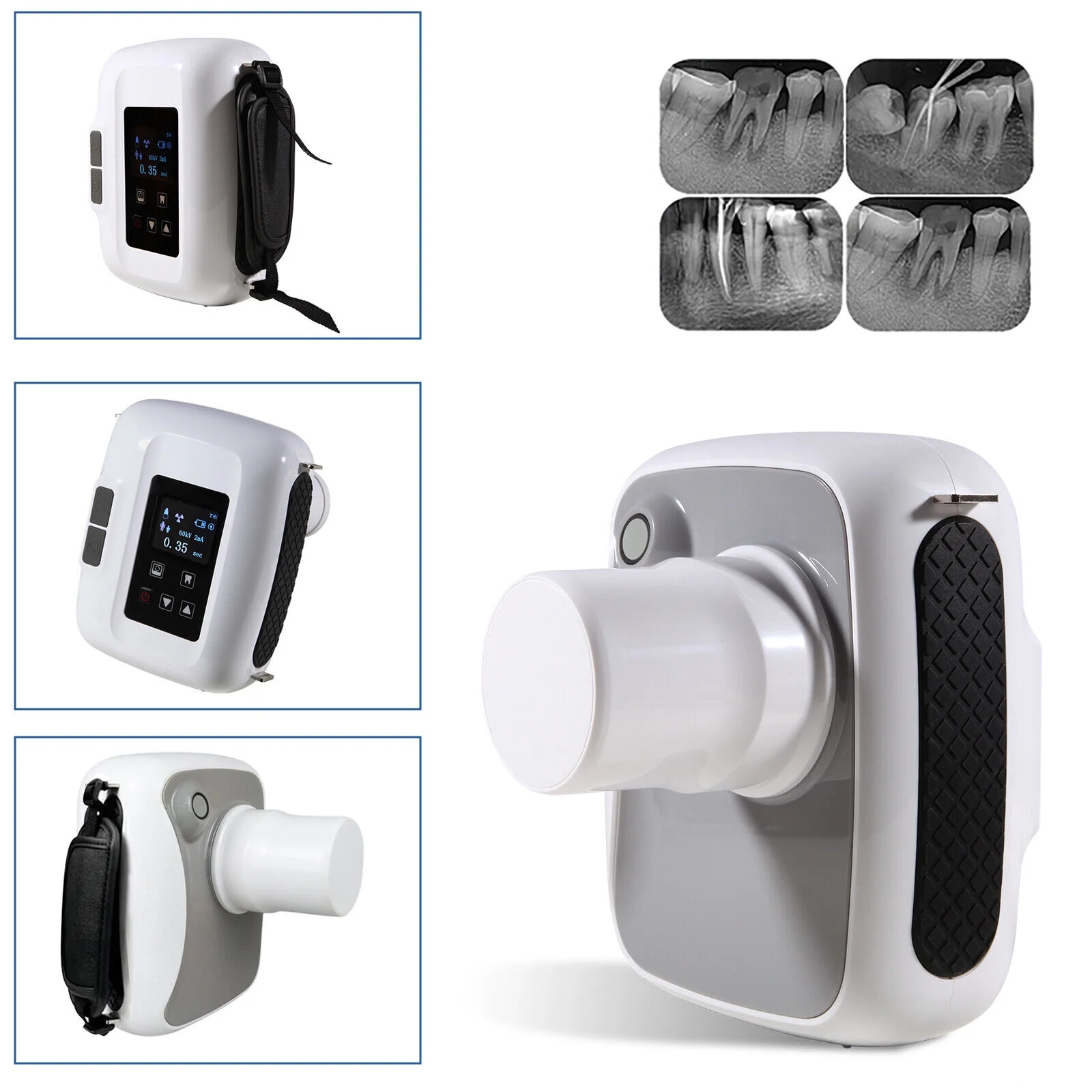 Dental X Digital Ray Machine WOODPECKE Digital X-ray High Frequency Xray Unit