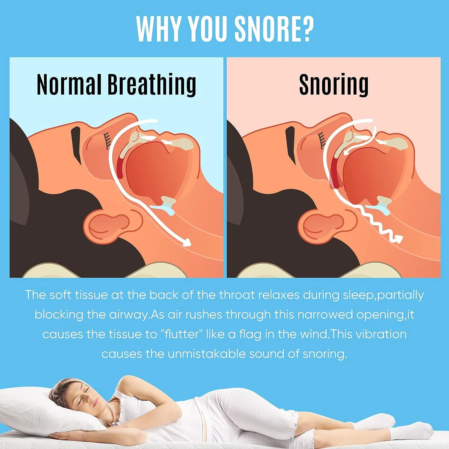 Anti Snoring Device Mouthpiece, Professional Comfortable&Adjustable Snore Mouthpiece,Snoring Solution for Men/Women Better Sleep