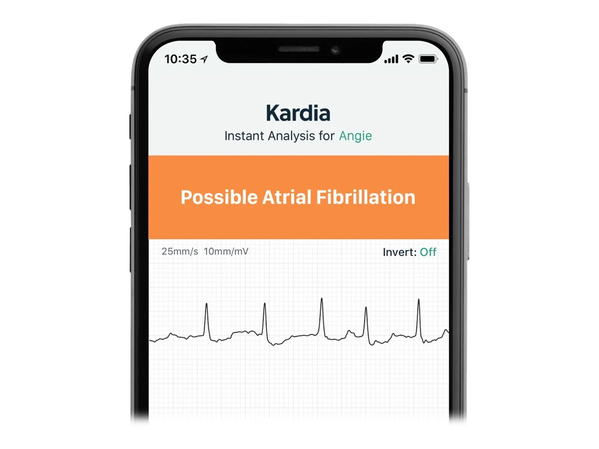 AliveCor Kardia Mobile 6L FDA Cleared- Mobile ECG Device, New