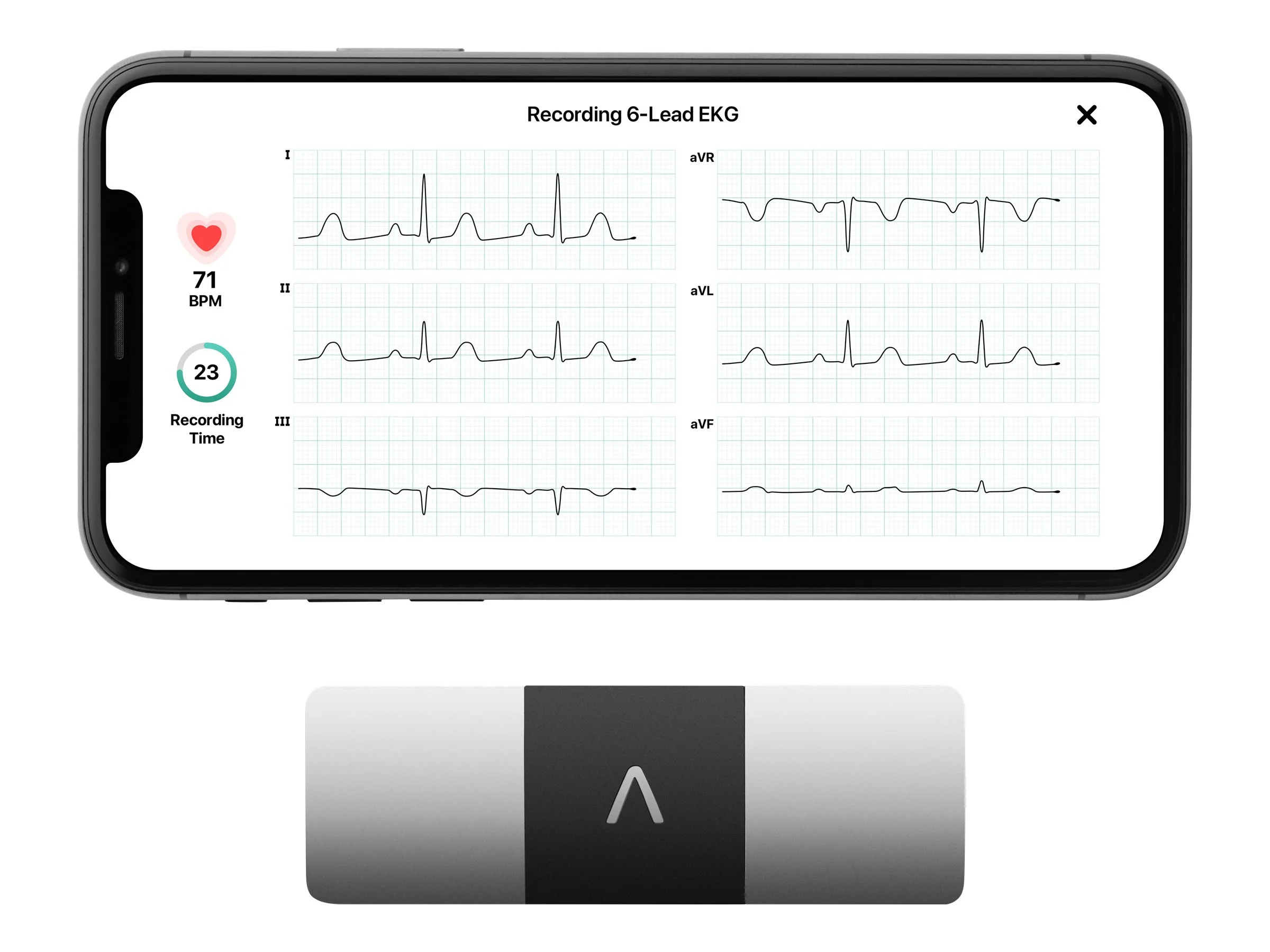 AliveCor Kardia Mobile 6L FDA Cleared- Mobile ECG Device, New