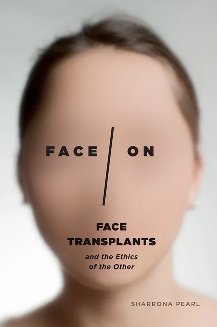 Face/On : Face Transplants and the Ethics of the Other (Paperback)