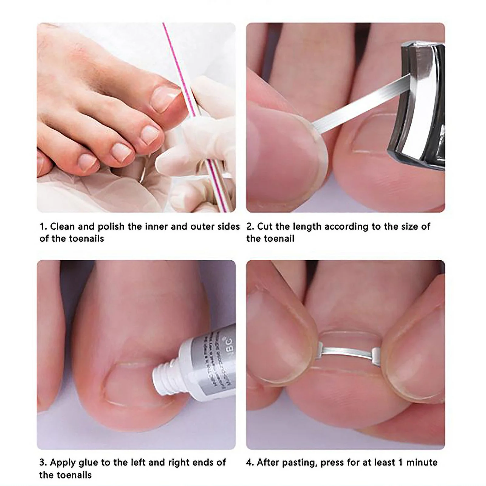 Ingrown Toenail Corrector Tools Pedicure Recover Embed Toe Nail Treatment Professional Ingrown Toenail Correction Foot Care Tool