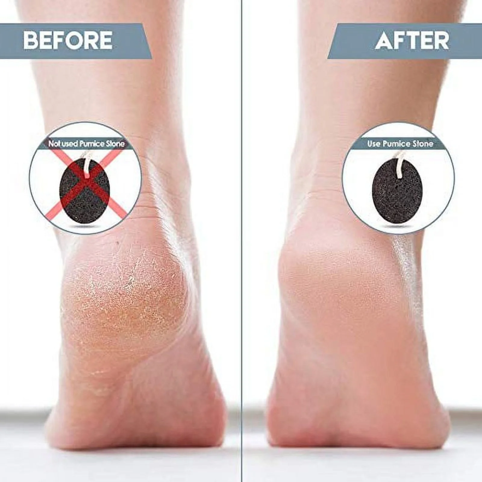 Jelly Pedicure Foot Care Tools Foot Grinding Stone Oval Honeycomb Foot Rubbing Stone To Dead Skin Heel Foot Black Foot Board