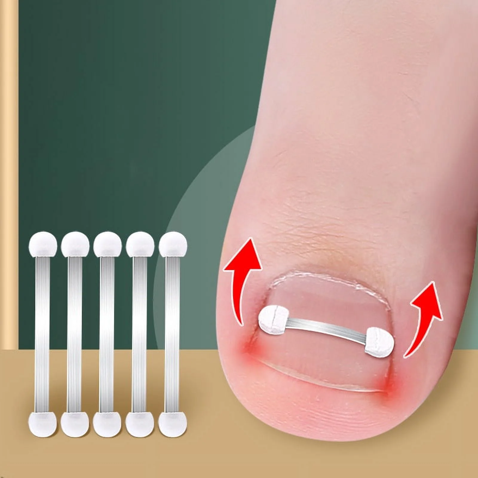 Ingrown Toenail Corrector Tools Pedicure Recover Embed Toe Nail Treatment Professional Ingrown Toenail Correction Foot Care Tool